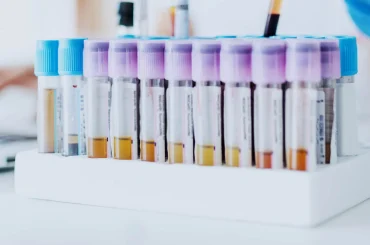 male-fertility-hormonal-testing-scaled-1